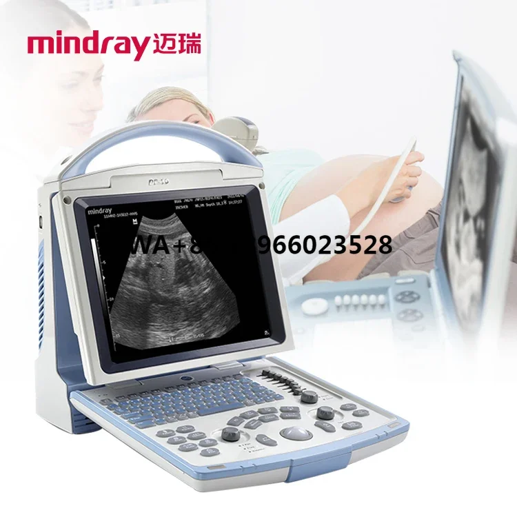 

Mindray Portable Medical Ultrasonido Sonografo Portatil Ecografo Mindray Dp 10 Ultrasound Machine