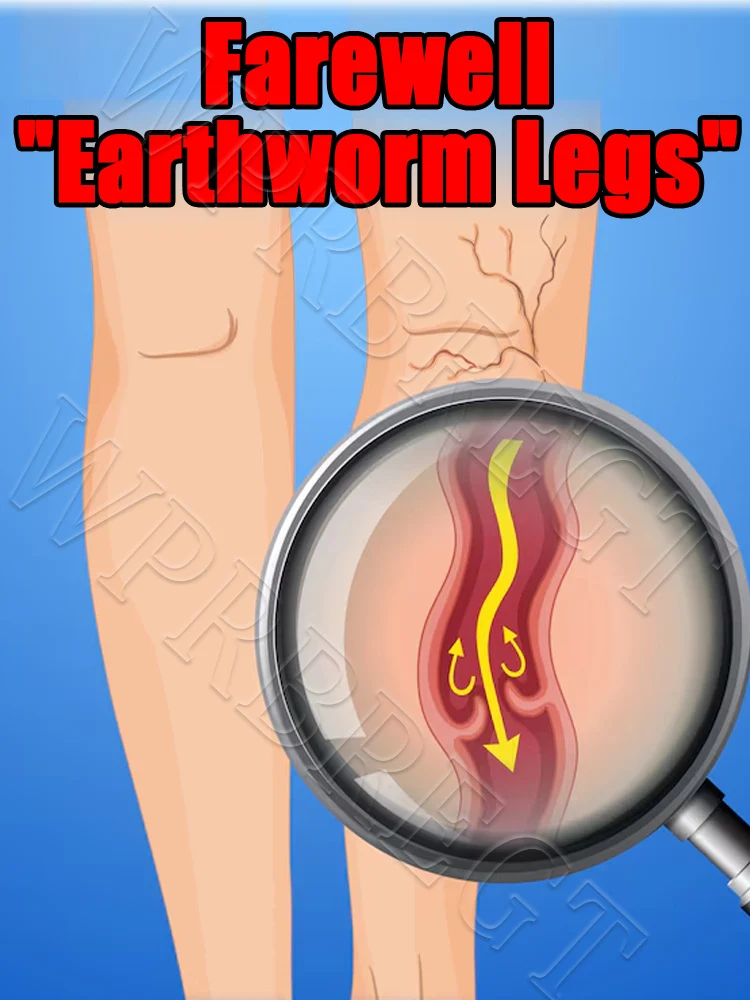 

Скажи нет «червячные ножки»