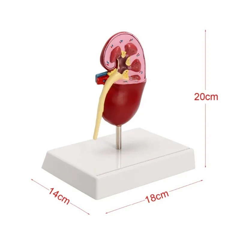 Anatomy Normal and Diseased Kidney Pathologies Medical Science Anatomical Model Human Body  Doctors Educational Tool