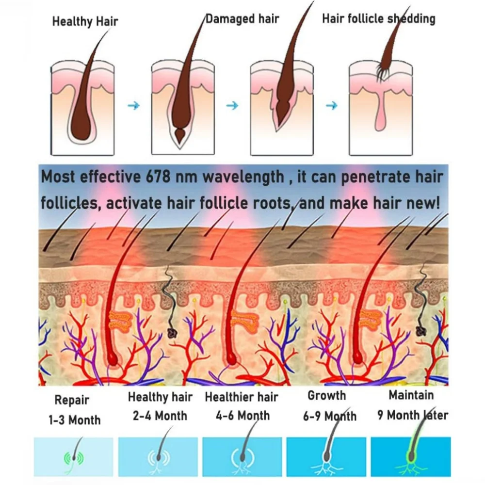 272 다이오드 레이저 광선 치료 헤어 성장 헬멧 모발 재성장 촉진 마사지 캡 탈모 방지 장치 두피 휴식 치료