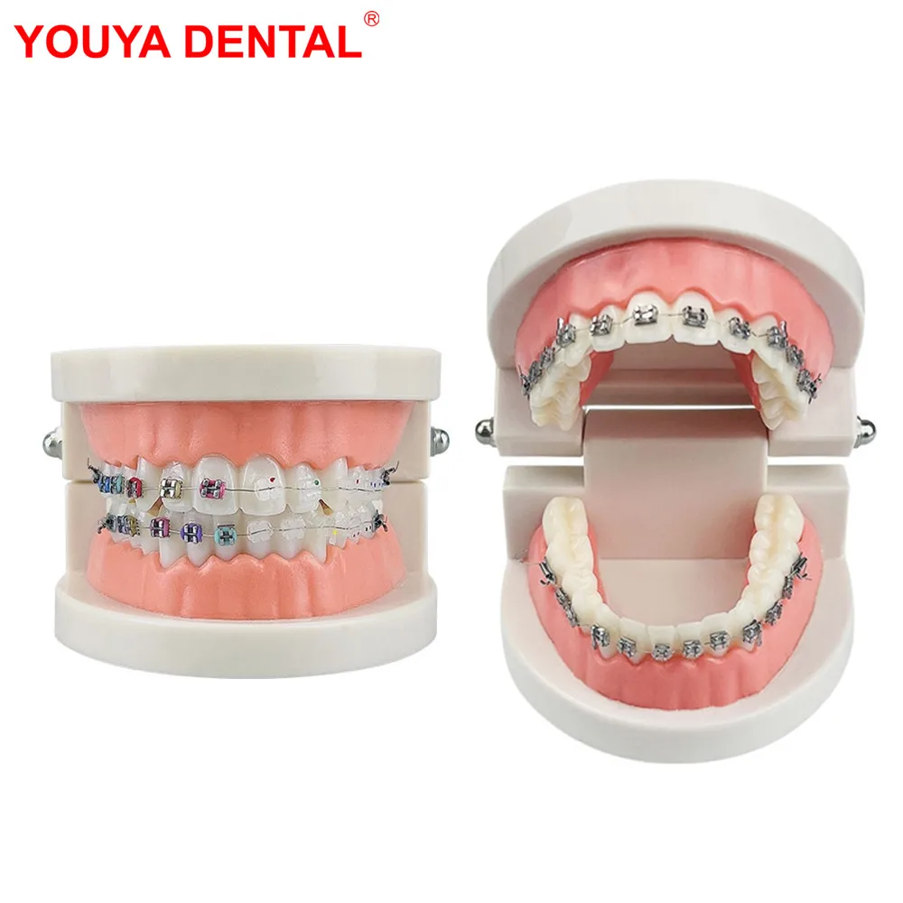 Dental Orthodontic Teeth Model With Braces Dental Teaching Model Metal / Ceramic Brackets  For Dentistry Education Studying Demo