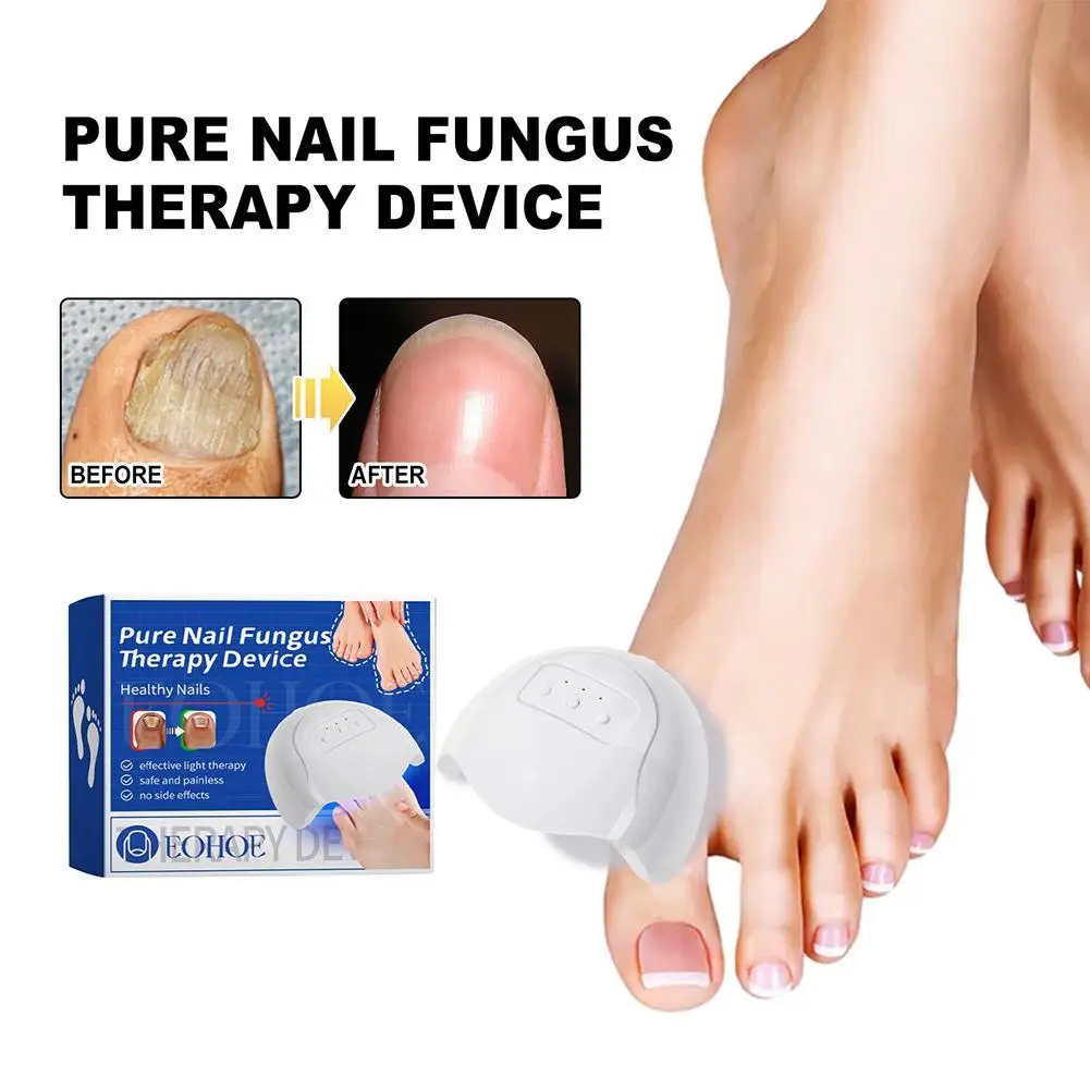 Fungal Toe Nail Device Repair Fast Toenail Nails Fungus Onychomycosis Repair Toenail Fingernail Removes Nail Fungus Treatment