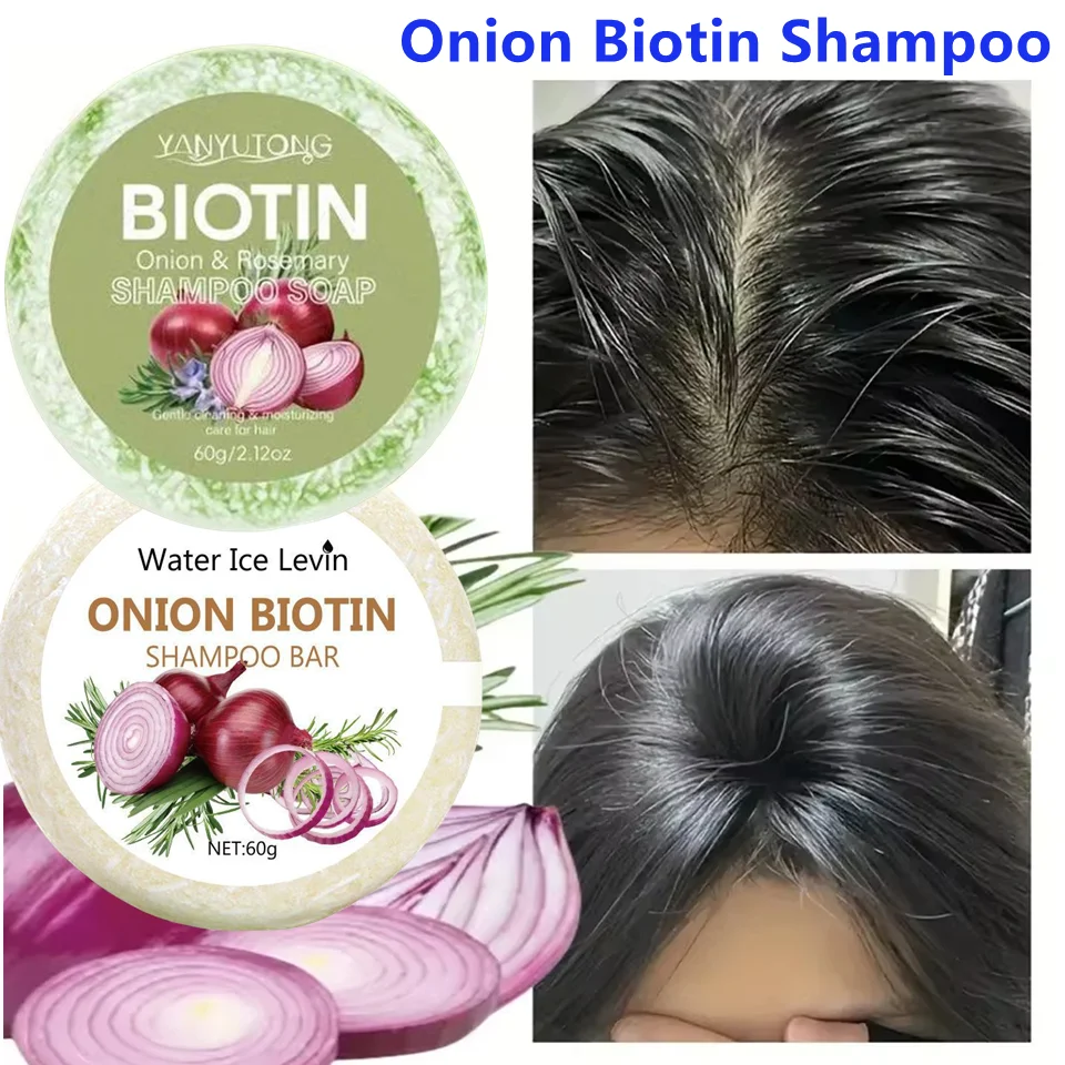 

60g Onion Rosemary Shampoo Soap, Handmade Soap Oil Control And Dandruff Removal Soap For Both Men And Women