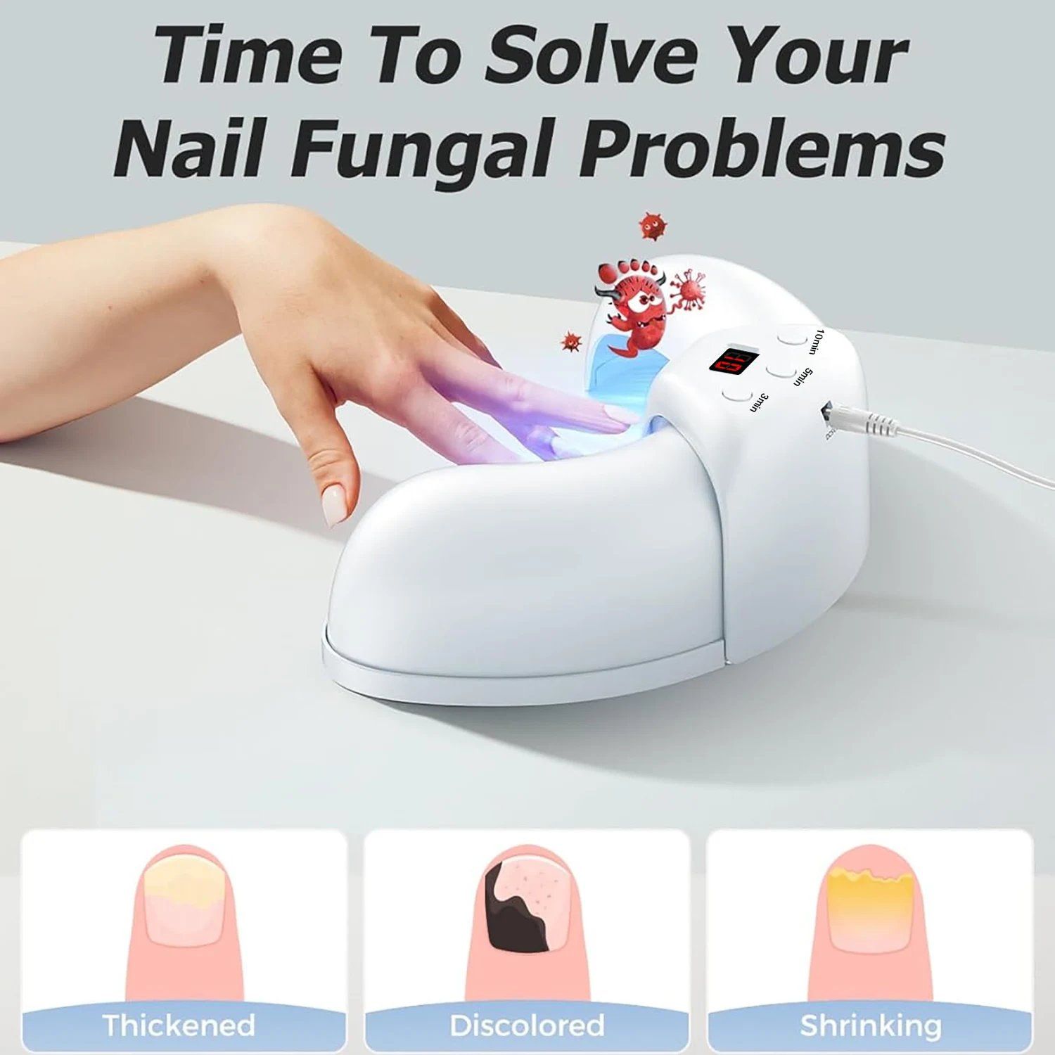 진균성 손발톱 레이저 기기 - 속효성 손발톱 진균증 및 내성발톱 치료, 발톱 및 손톱 곰팡이 제거로 발 관리