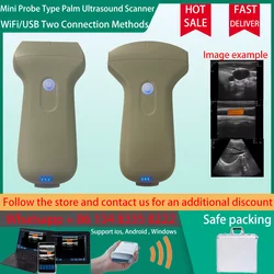 Portable Wireless Ultrasound Wifi/USB Connection Scanner 96E  Probe Machine Color Linear/Convex Doppler Sonostar Brand Factory