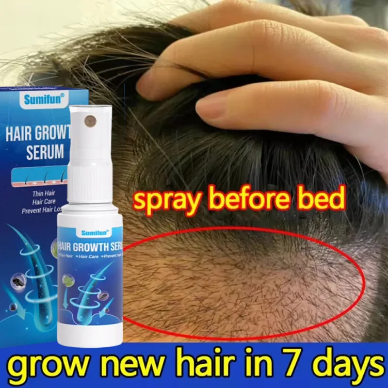 

Hair Growth Spray Promote Rapid Hair Growth Hair Loss Treatment Dense Hair Essence Scalp Loss Repair Nourishing Hair Care