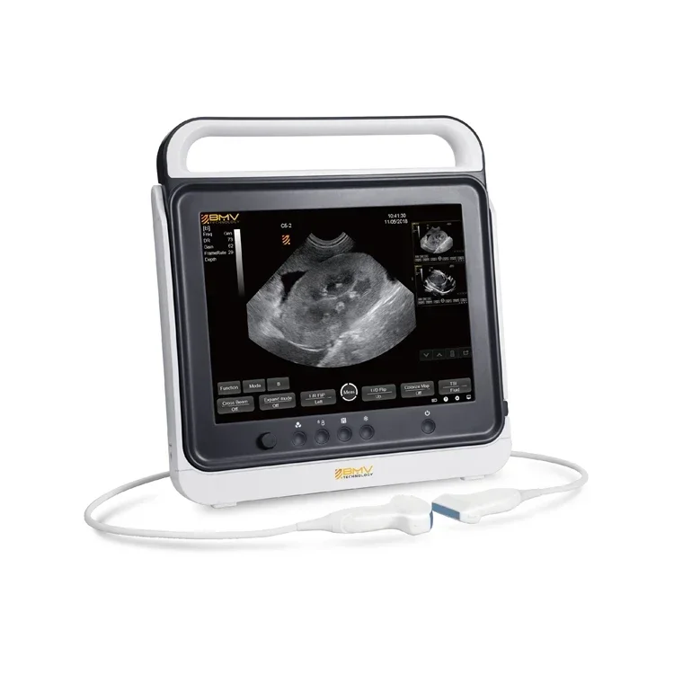 Laptop B/W Ultrasound Color Doppler Ultrasound Portable Veterinary Ultrasound With Cheap Price