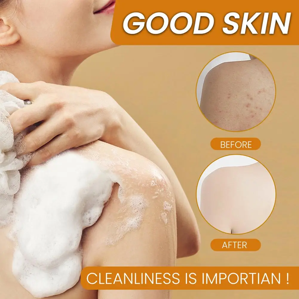 صابون الكركم لتنظيف الوجه ومضاد لحب الشباب وتبييض البشرة وتفتيح الوجه وإزالة البثور وتفتيح الزنجبيل صابون يدوي الصنع