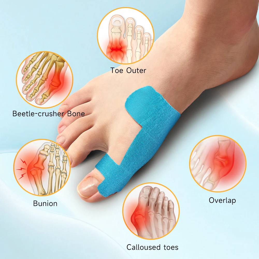 Precut Kinesiology Tape for Bunion Corrector Big Toe Support Hallux Valgus Protective Tape Toe Corrector Straightener 10PCS/SET