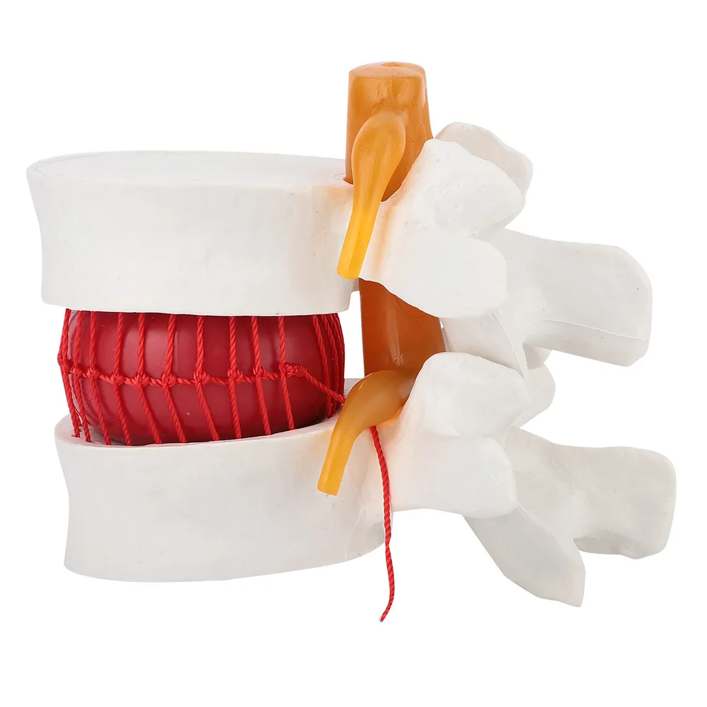 

Lumbar Model 1:1.5 Vertebral Spine Human Lumbar Disc Herniation Model Demonstration Model Of Lumbar