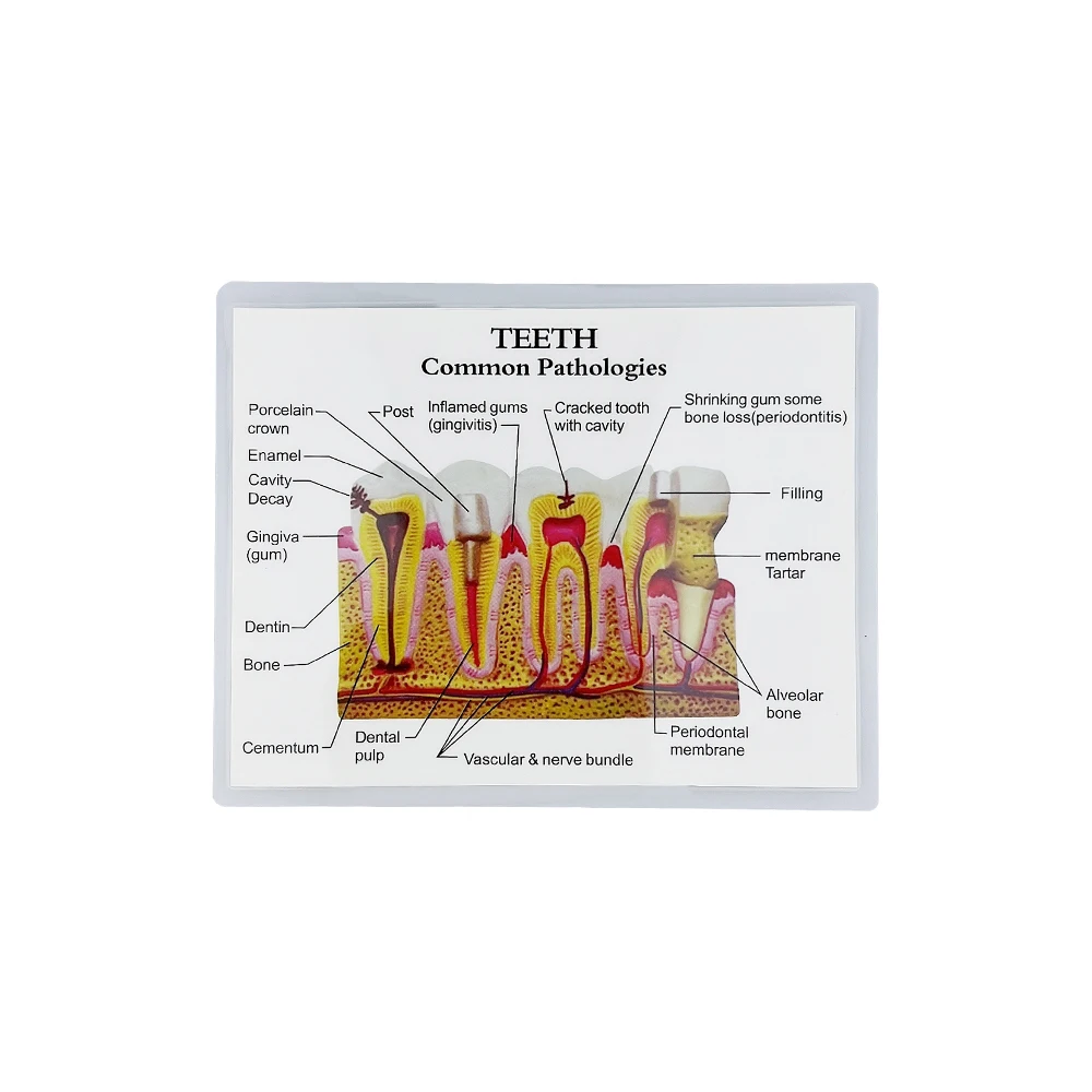 Patologie stomatologiczne anatomiczny Model struktury do nauczania badania leczenia kanałowego demonstracyjna dentysta dla pacjenta