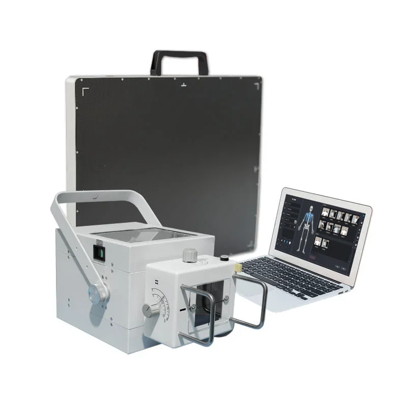 High Quality Portable Digital X-Ray Machine Mobile X Ray Medice Equipment DR with Flat Panel Detector to Use Human Animal