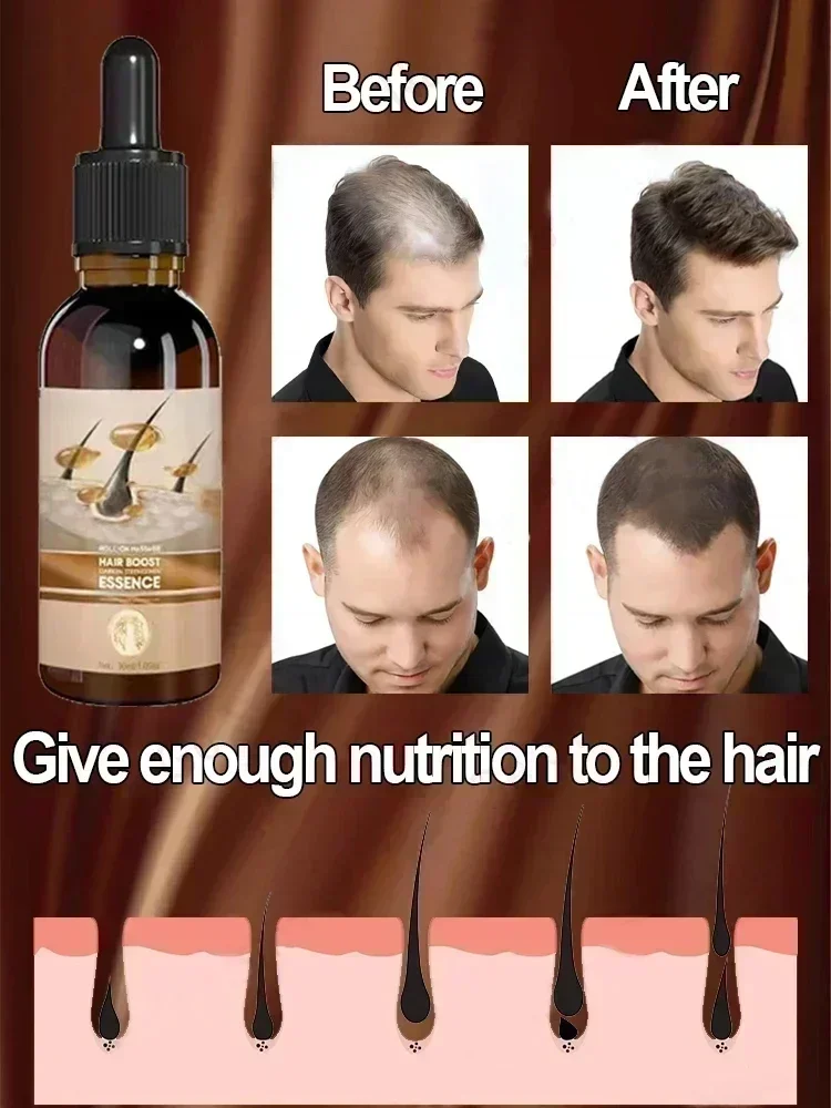 Anti Hair Loss Scalp Treatment Serum Beauty Health Products Fast Hair Growth for Men Women Ginger Oil Care