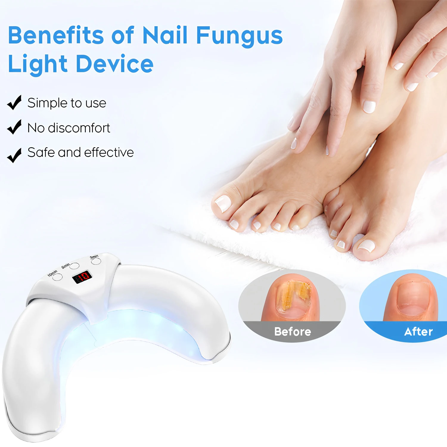 진균성 손발톱 레이저 기기 - 속효성 손발톱 진균증 및 내성발톱 치료, 발톱 및 손톱 곰팡이 제거로 발 관리