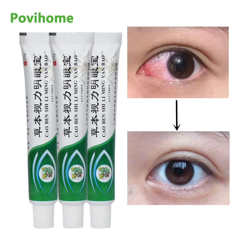 

1/3pcs 20G Herbal Eye Ointment Eyesight Eye Dry Red Blood Bright Clean Antibacterial Cream Soothing Massage Cream Eye Care Cream