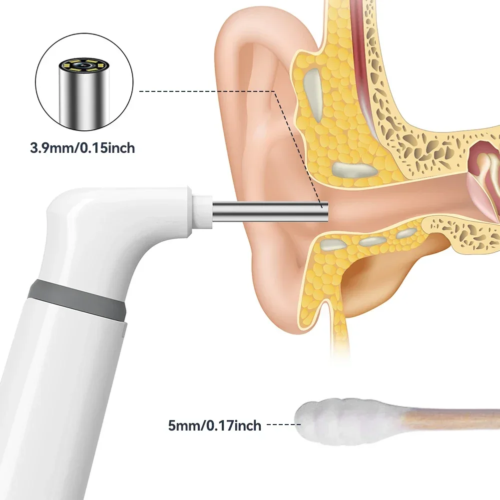 Imagem -03 - Câmera Endoscópio Wifi Limpeza do Ouvido Inspeção Otoscópio Limpador de Cera Ferramentas de Remoção para Iphone Android 3.9 mm Endoscópio