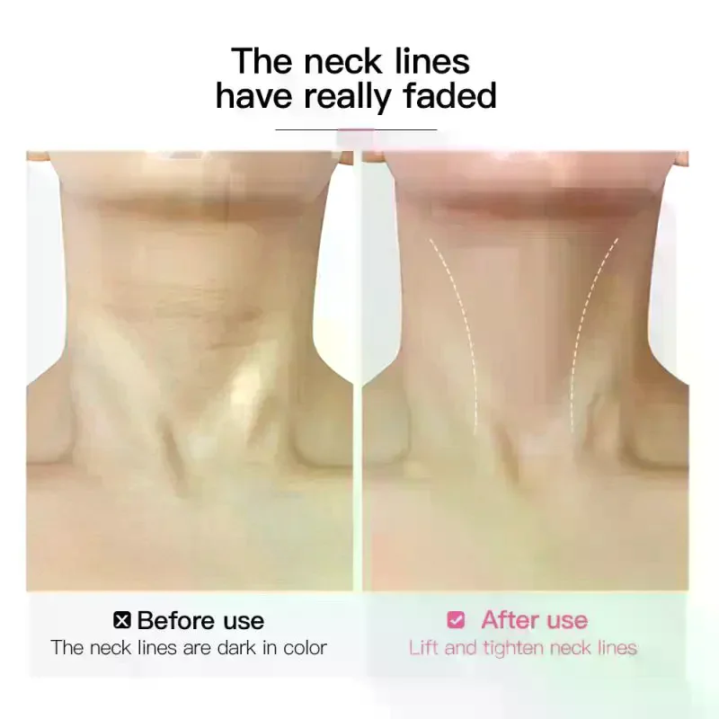 

10Pcs Neck Lifting Patches Waterproof Elasticity Invisible Fading Neck Wrinkle Adhesive Stickers Face Lift Tape Elastic Bands