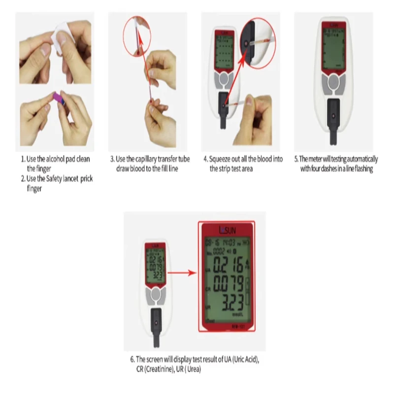 Lysun Kidney Function Test Renal Function Meter Uric Acid+creatinine+urea 3in1test Analyzer with Lab Quality for Clinic Use