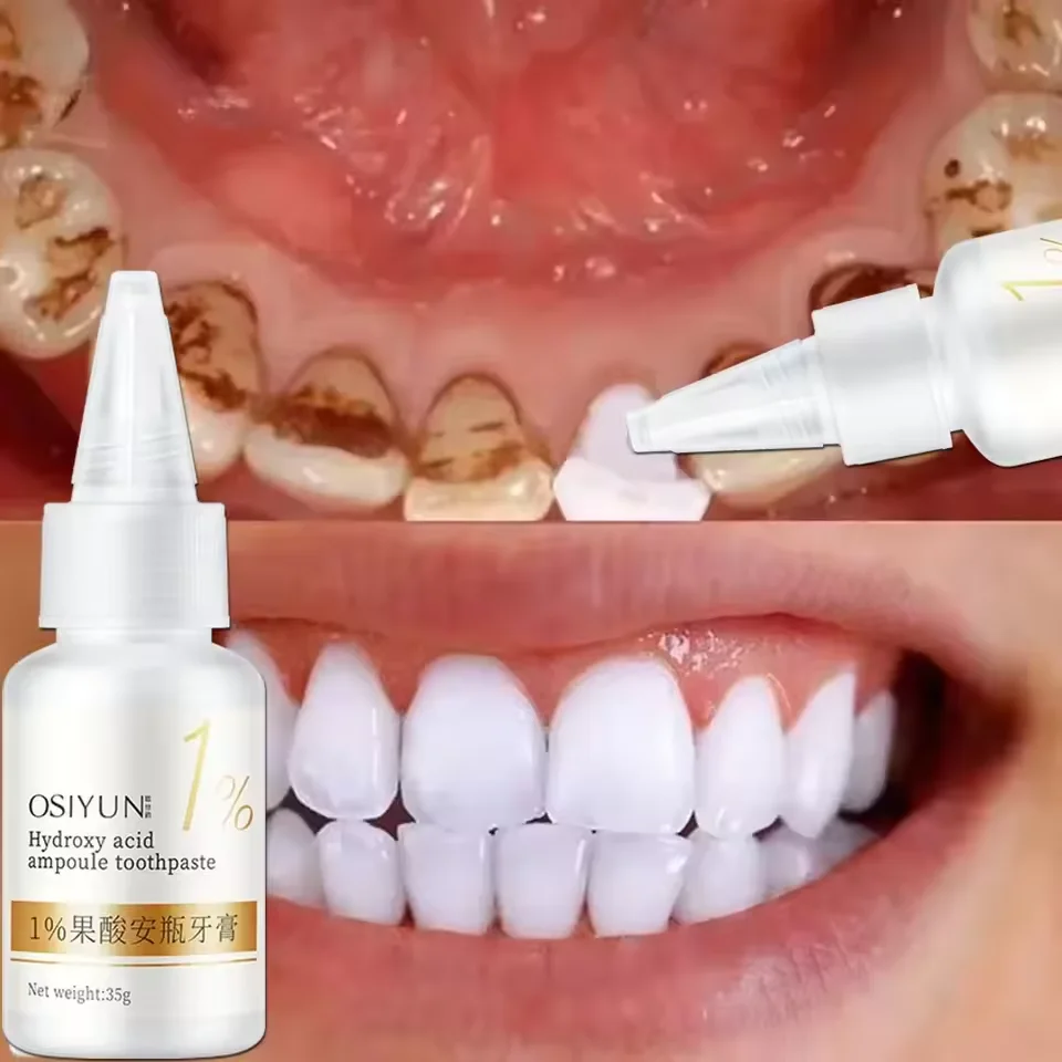 Teeth Whitening Toothpaste Fruit Acid Remove Calculus Plaque Stains Fresh Breath Cleaning Oral Hygiene Dental Bleach Care Tools