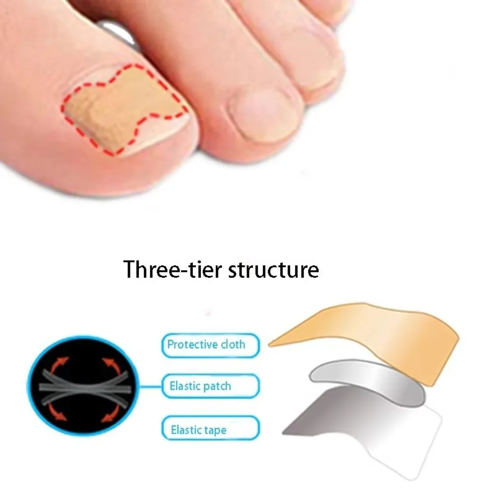 100Pcs Adhesive Ingrown Toenail Correction Stickers Flexible Elastic Nonwoven Toenail Shaping Strips Breathable