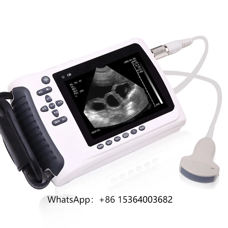 

Good Price Vet Handheld Ultrasound Scanner & Wholesale Portable Diagnostic Equipment - Hot Selling Medical Ultrasonic Machine