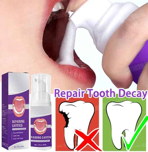 

Teeth Whitening Toothpaste Removing Dental Calculus Protect Teeth Freshens Breath Anti-cavity Tooth New