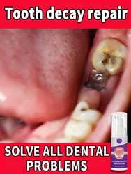 Tooth Decay repair