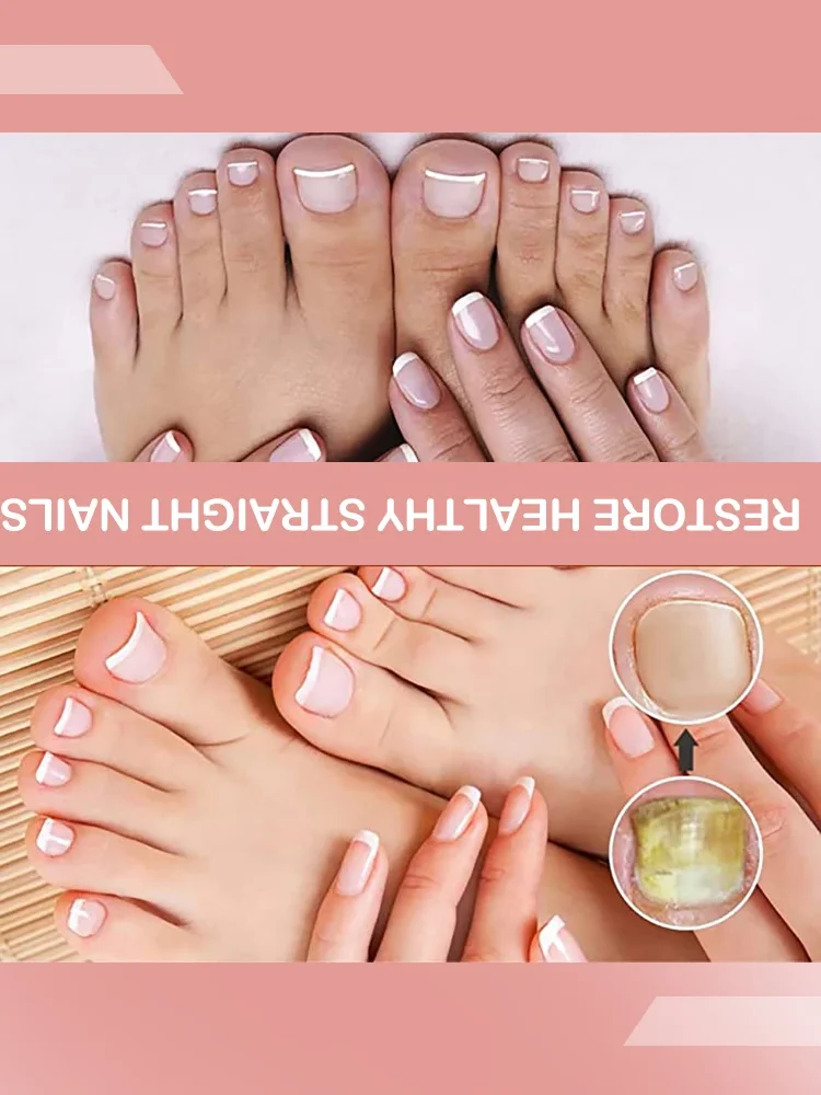 Nail Device Repair Toe Foot Essence