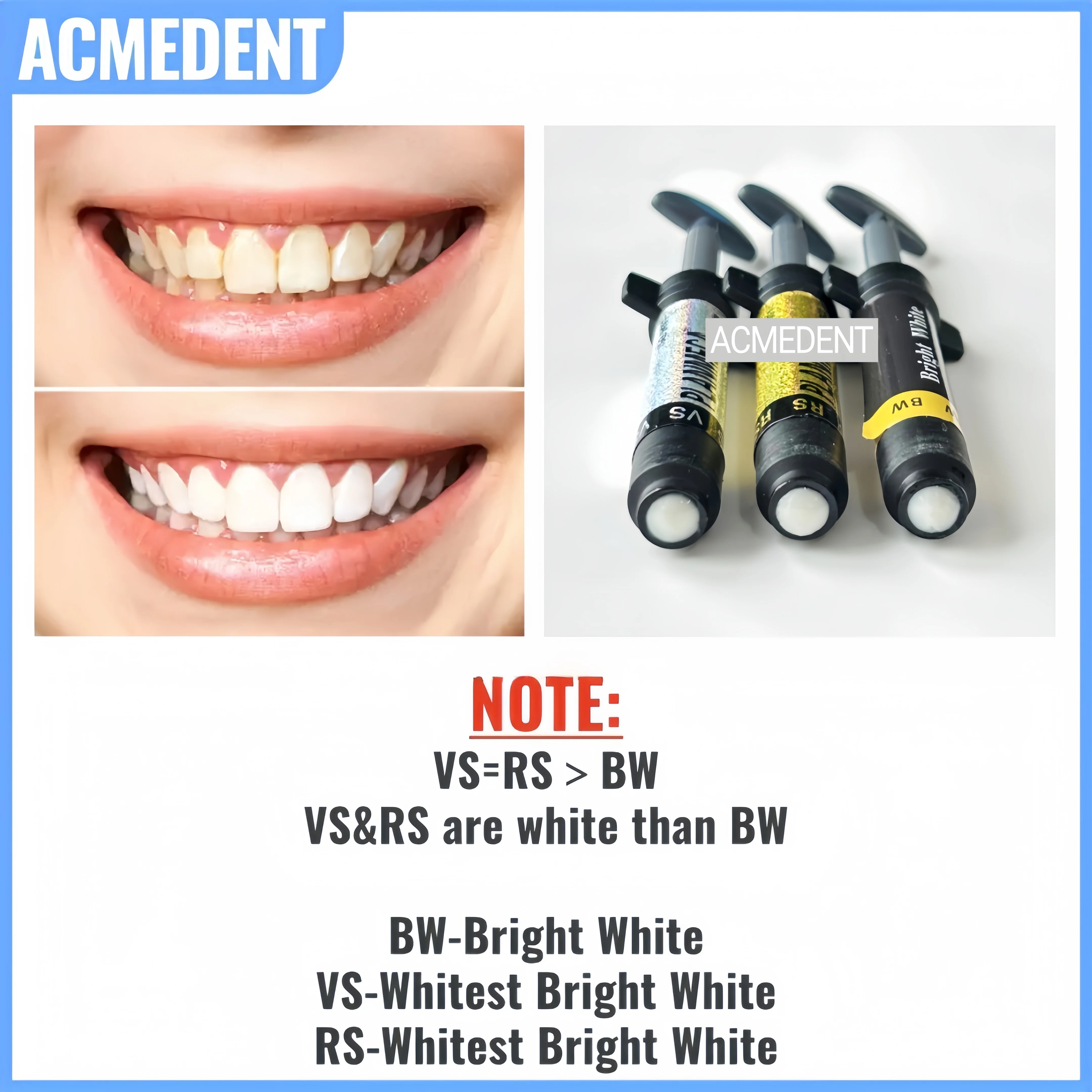 4.5g VS Dental Light Cure Ibri - Teeth Whitening Vs Veneers recensione e prezzo