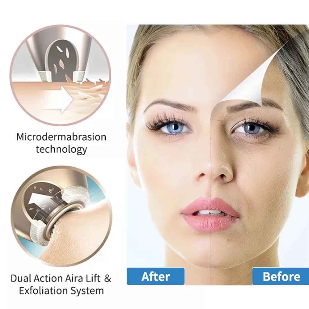 Portable Microdermabrasion Suction Machine Upgraded Diamond Microderm Machine For Blackhead Removal Skin Care Facial Cleaning