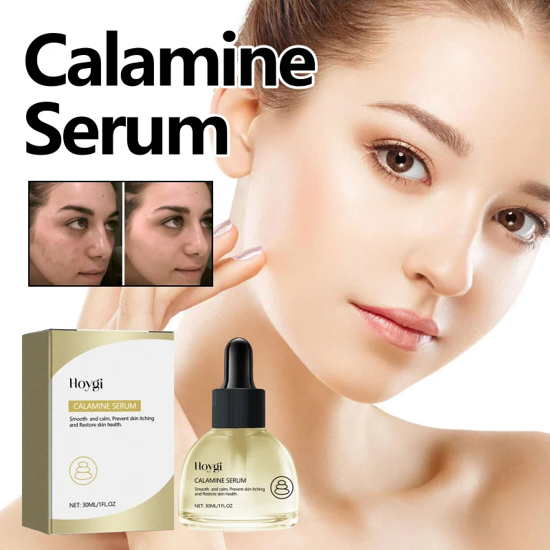 

Calamine Facial Serum, Improves Dry & Dull Skin, Aids Acne-Prone Skin & Pimples, Soothes, Hydrates, Plumps Skin