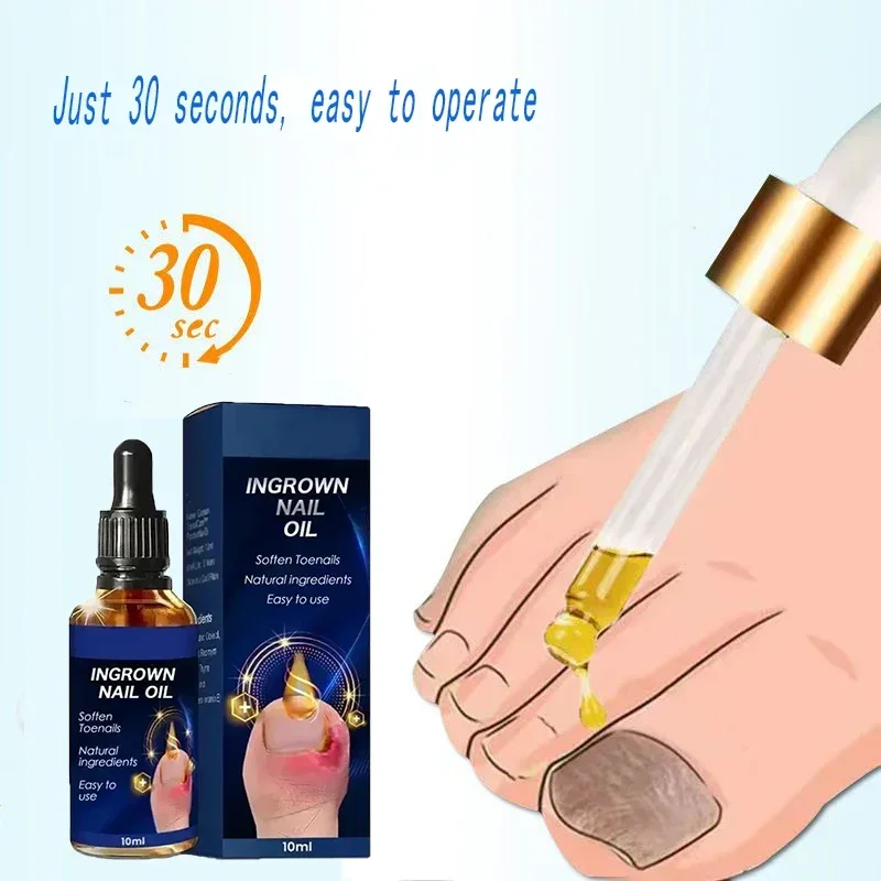 

Nail Fungals Renewal Nail Repair Liquid for Discolored Thickened Crumbled Nails Nail Fungals for Discolored Broken Cracked S5F6