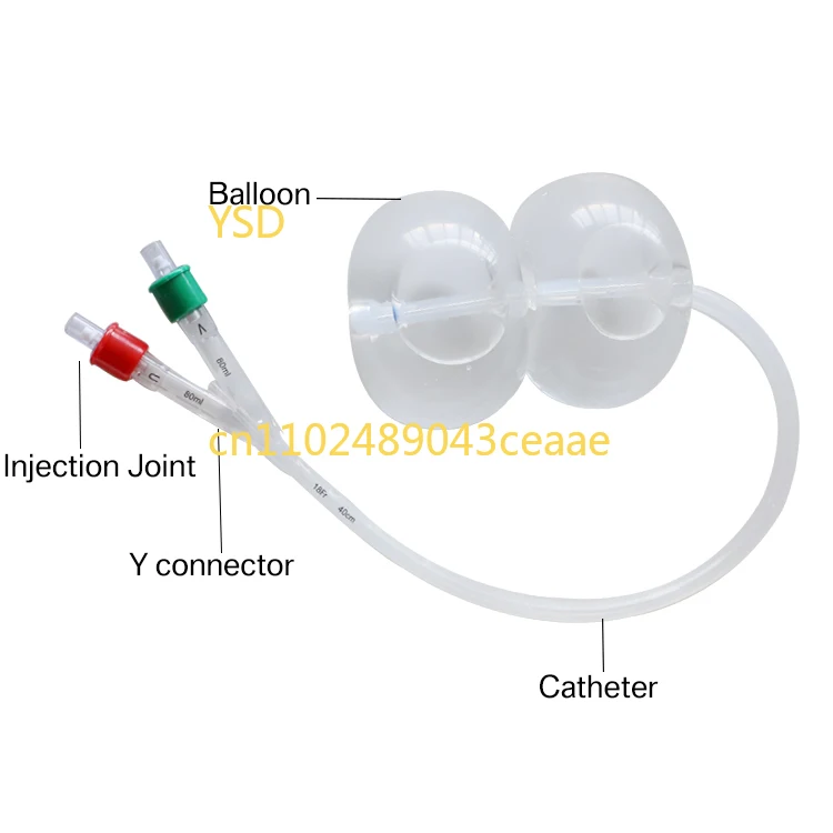 

Minimally invasive disposable cervical dilation balloon catheter