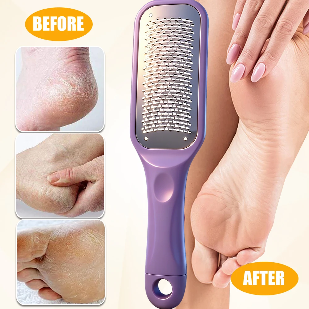 1/2/4Pcs Foot File Callus Remover Foot Rasp Pedicure Scrubber Tool for Feet Care Stainless Scraper Cracked Dead Skin Remover