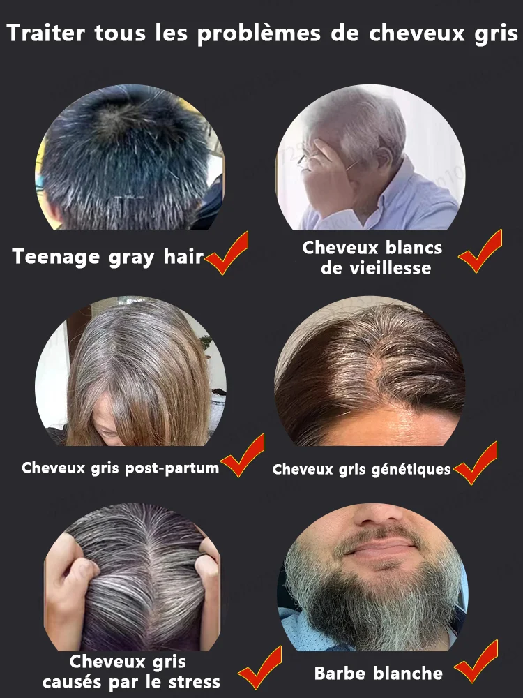 Image 5: Essence anti-blanchissante naturelle pure, élimine les cheveux blancs et noircit les cheveux dès les racines
