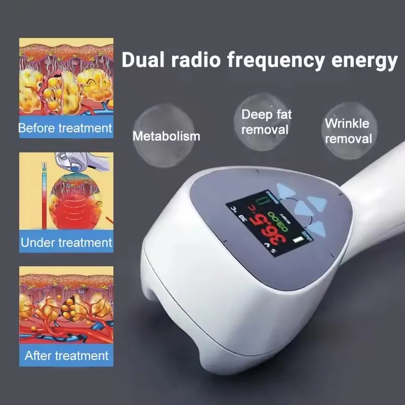 360 Anti Aging Firming Eye Enhancement Body Shaping Fat Cellulitis Slimming Upgraded RF Weight Loss Machine