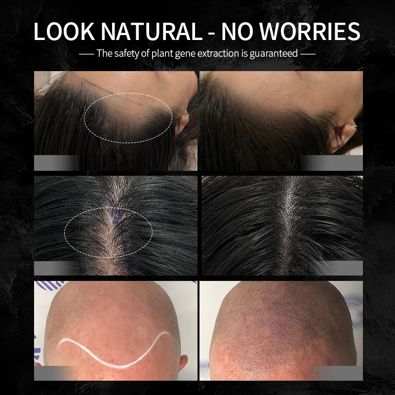 BORALA SMP Aftercare Cream Professional Scalp Micropigmentation for Permanent Makeup Beauty Health Tattoo Supplies 50g - Image 2