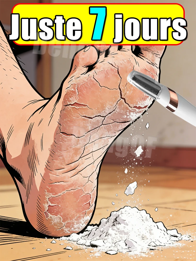 

Новый электрический скрабер для ног, средство для удаления огрубевшей и сухой кожи, профессиональный инструмент для ухода за ногами.