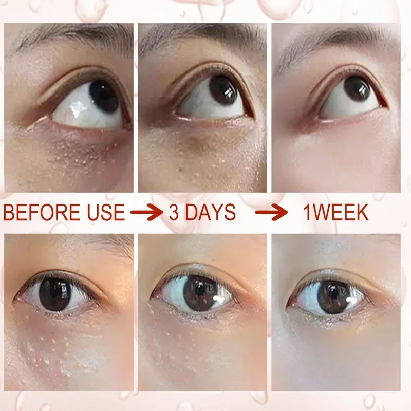 Eyes Cream Remove Dark Circles Eye Bags Fade Fine Lines Fat Granules Remover Anti-puffiness Wrinkles Lift Firming Eye Skin