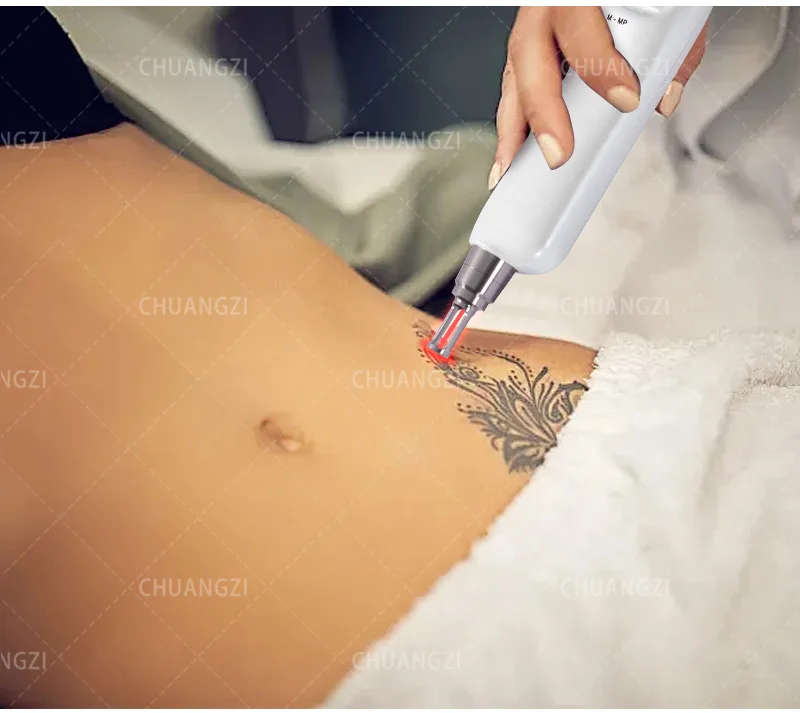 

Portable Laser 2 In 1 Nd Yag Tattoo Removal Machine IPL OPT L-aser Hair Removal Machine ND YAG Tattoo Removal Hair LaserPortable