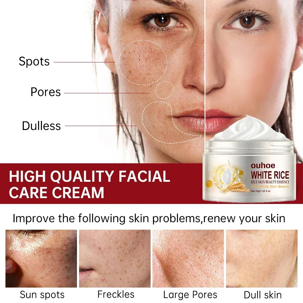 Arroz branco branqueamento creme facial, remover manchas escuras, sarda, melanina, anti rugas, envelhecimento, hidratante, iluminar cuidados com a pele, novo