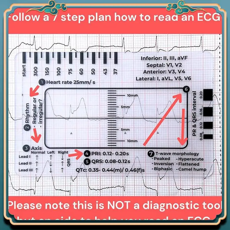 (Новинка) - Шаговая линейка ЭКГ 7, шаговая линейка ЭКГ для перевода ЭКГ/ЭКГ, инструмент для быстрого и быстрого анализа кардиологического анализа и измерения