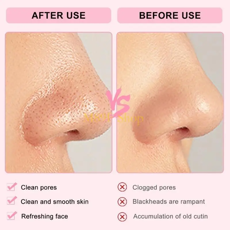 M89f Gentle Exfoliant Silicone Brush Brush Kitten Paw Face Tool pour le retrait tête noire