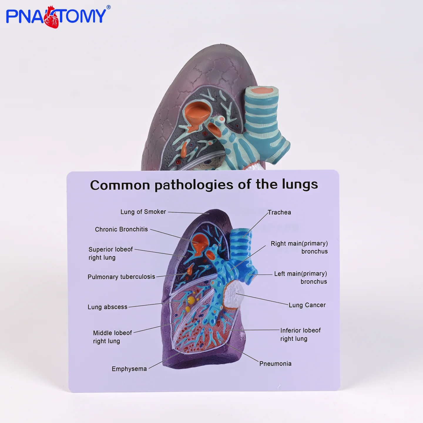 

Human Pathological lung model simulation Smoking Pneumoconiosis Pulmonary Anatomy demonstration Teaching AIDS Bronchial