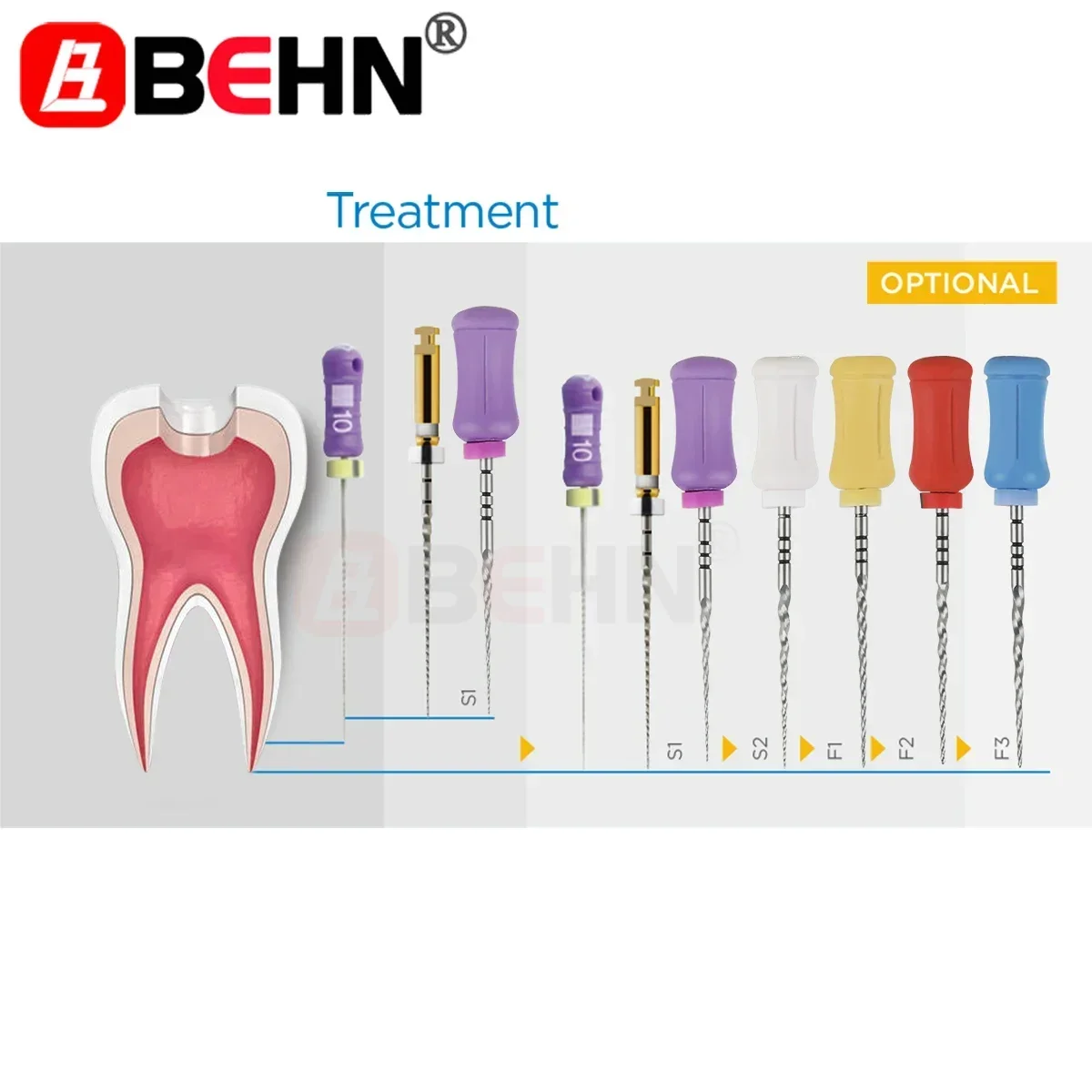 BEHN 치과용 근관치료 손 사용 열 활성화 로터리 파일, NiTi 근관 슈퍼 파일 SX-F3, 25mm, 상자당 6 개