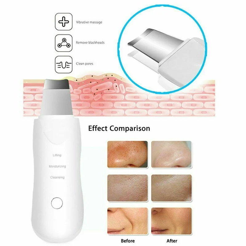 Skin Cleaning Device Charging Face Electric Scrubbers Facial Cleansing Beauty Device Professional Ultrasonic Skin Scrubber