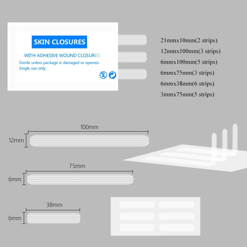상처 피부 봉합 스트립, 접착식 의료 봉합 프리 수술 테이프, 산후 상처 복구, 화장품 수술, 멸균 스트립, 4 백