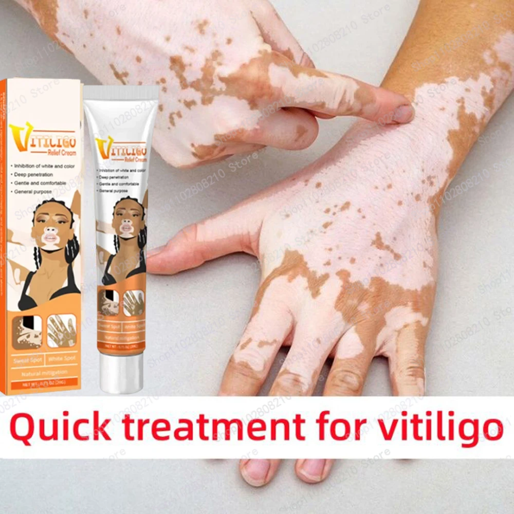 Pomada de Vitiligo para eliminar eficazmente las manchas blancas, elimina el Vitiligo de la piel, cuidado de la piel corporal