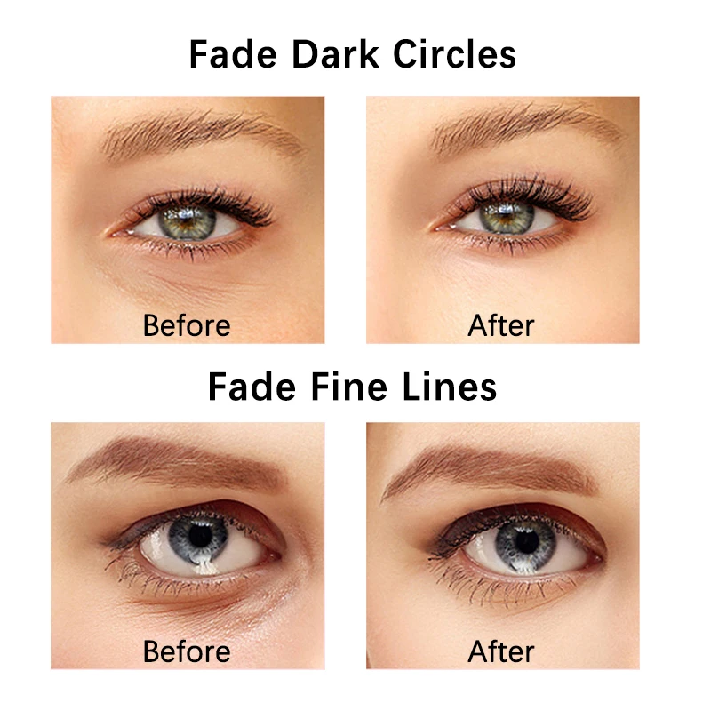 Ohio eur facial EMS LED pour les yeux, vibration chauffante, raffermissement de la peau, élimination des déformations, essence de beauté, anti-âge, raffermissement de la peau, baguette de beauté