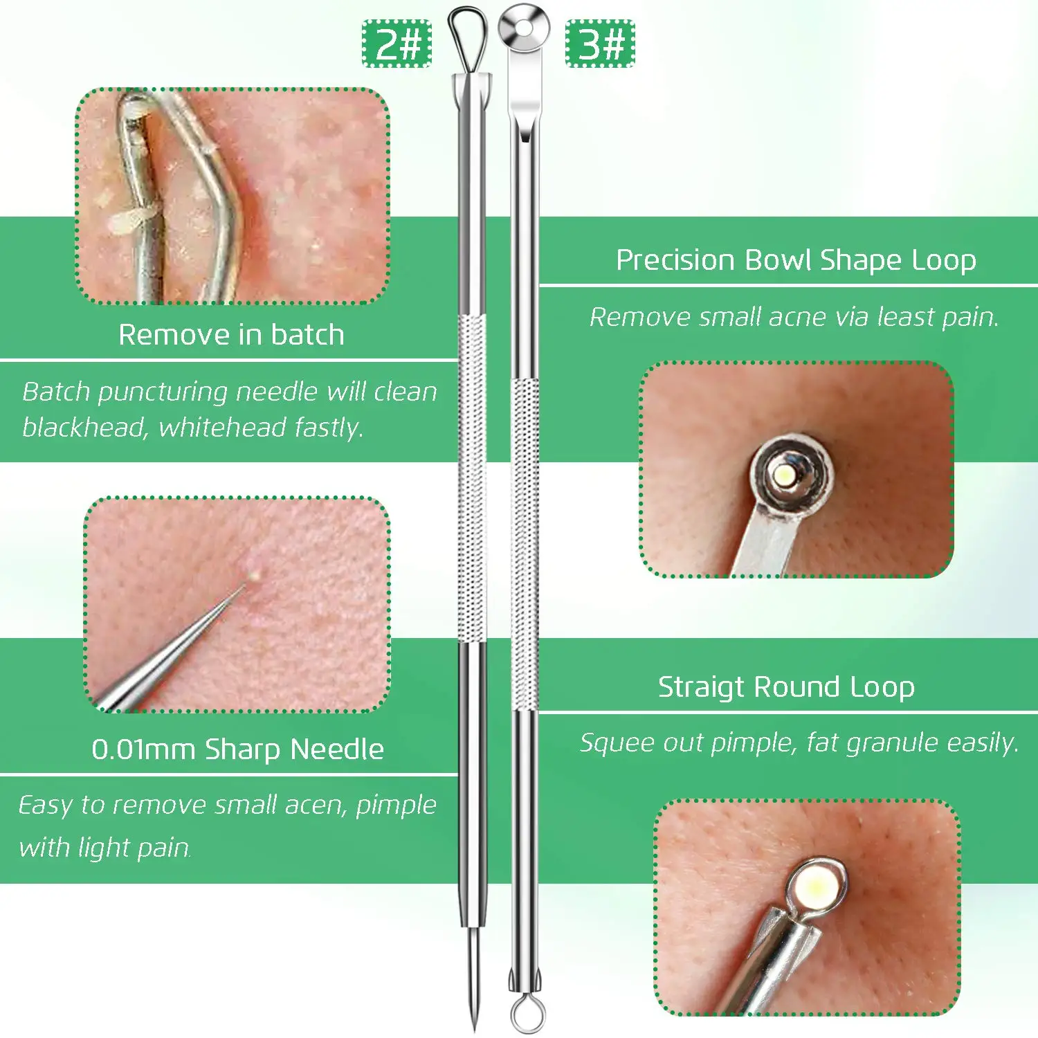 Estrattore di comedoni per la rimozione di punti neri da 5 pezzi, kit di pinzette per punti neri curvi, anche per la rimozione delle imperfezioni dell'acne con brufoli in acciaio inossidabile professionale